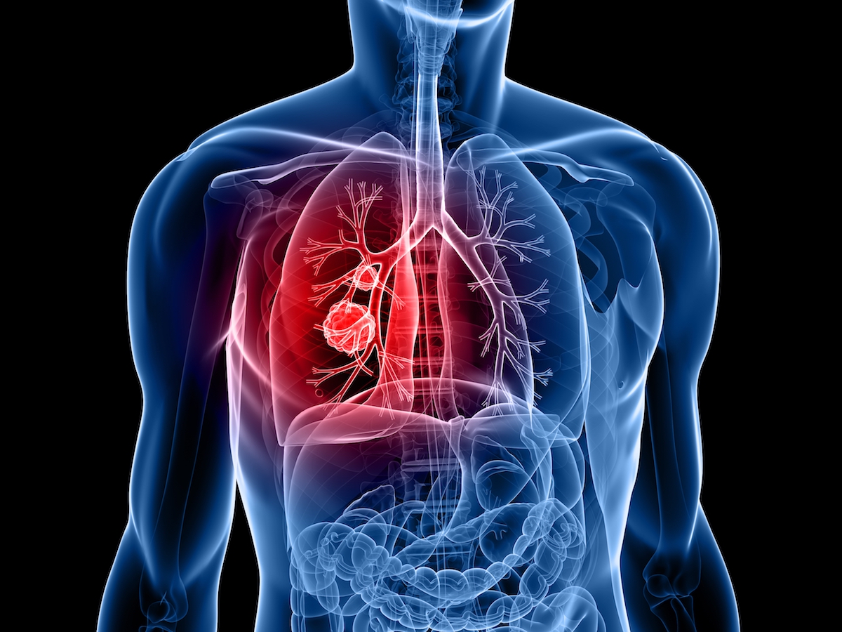 new research lung cancer